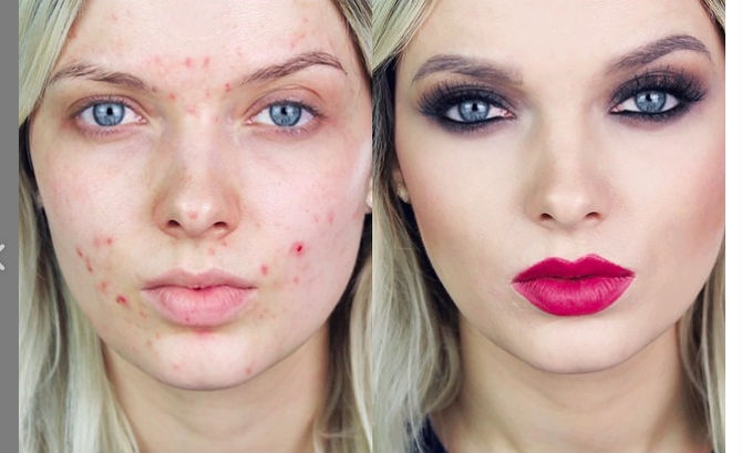 YouTube-Video-From-Acne-Make-Up-Coverage-Guru-Em-Ford-Called-You-Look-Disgusting-Gets-417-Million